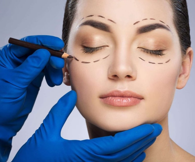 Βλεφαροπλαστική