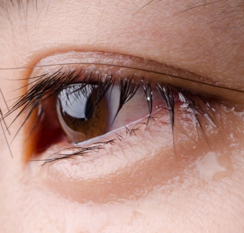 Δακρύρροια