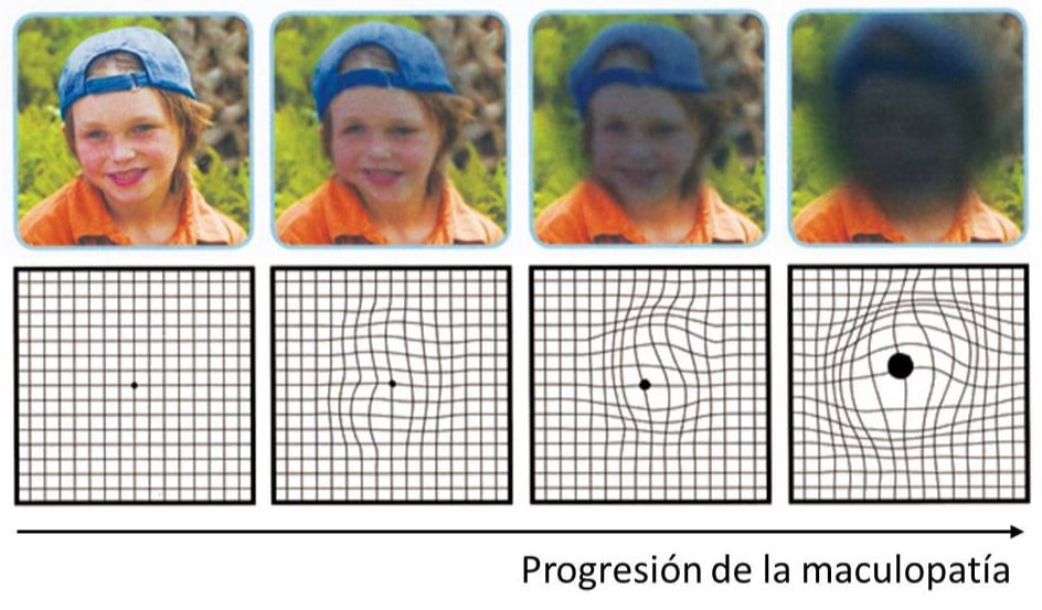 Ωχρά Κηλίδα